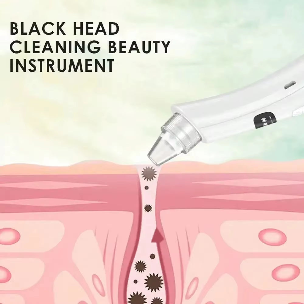 3-Mode Blackhead Vacuum Cleaner