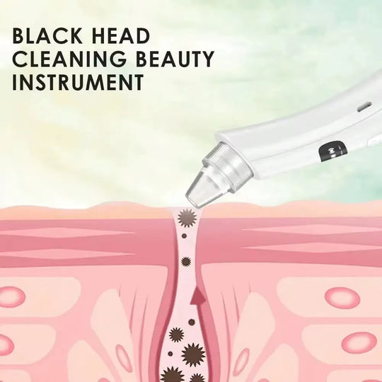 3-Mode Blackhead Vacuum Cleaner