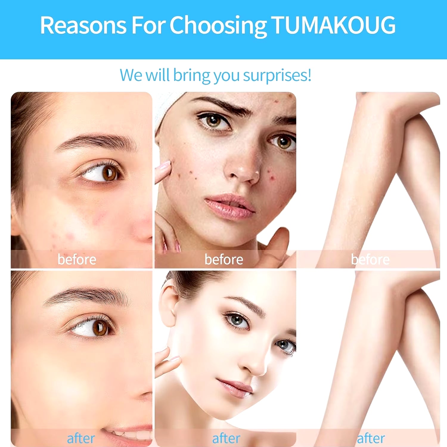 4-in-1 High-Frequency Skin Wand